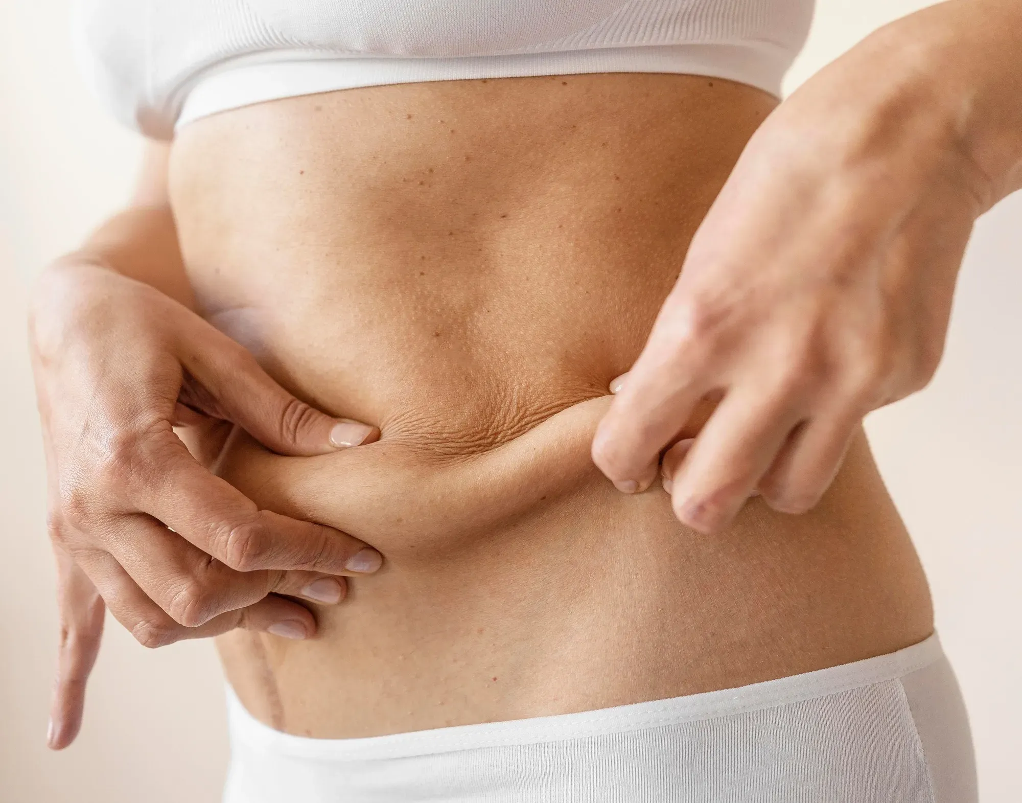 Was ist cellulite? Warum bekomme ich sie und an welchen stellen?