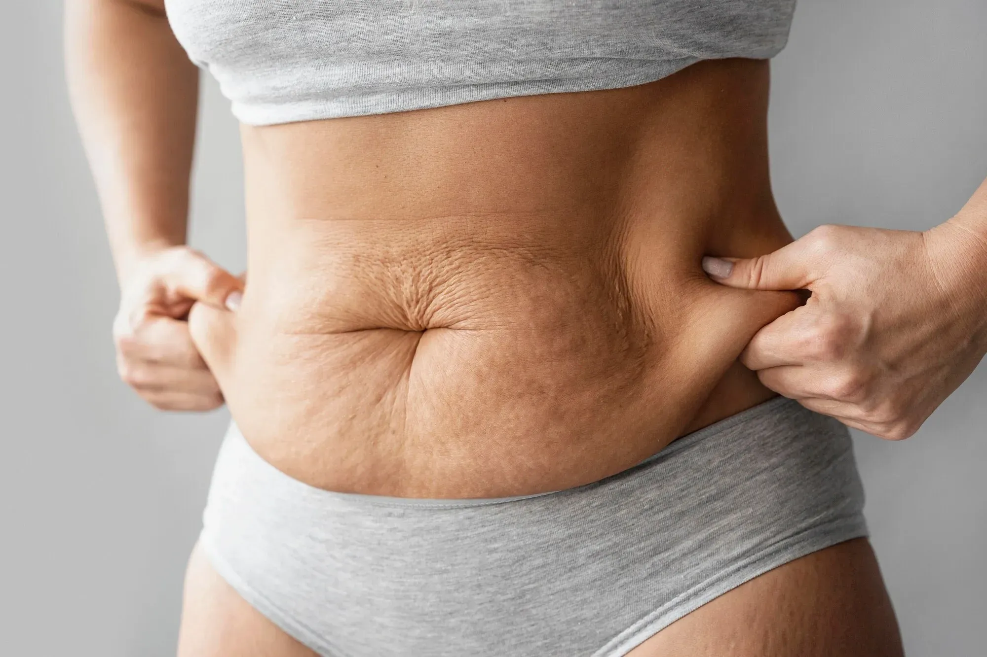 V-SHAPE Orangenhaut effektiv bekämpfen